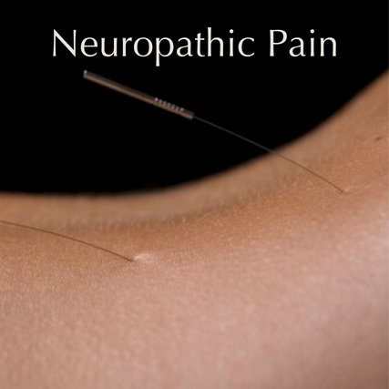 Acupuncture for neuropathic pain
